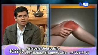 Artrosis de Rodilla Klgo Marco Loyola [upl. by Hyacinthe846]