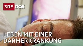 Colitis Ulcerosa – Moderator Robin Rehmann und seine Krankheit  Reportage  SRF [upl. by Yenrab180]