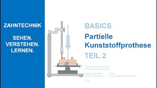 Partielle Kunststoffprothese  Teil 2 [upl. by Terrie]