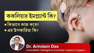 ককলিয়ার ইমপ্ল্যান্ট কি কিভাবে কাজ করে এর উপকারিতা কি  Cochlear Implant  How Does it Work [upl. by Nerral]