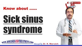 Sick sinus syndrome SSS  Causes Diagnosis Symptoms Treatment Prognosis [upl. by Marnia]