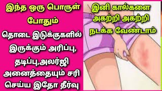 தொடை உரசிஉரசி தடிப்பு அரிப்பு ஏற்படுகிறதா இதோ தீர்வுRasi TipsCandid powderrashesitching [upl. by Millham]