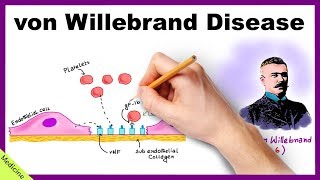 VON WILLEBRAND DISEASE Pathophysiology Clinical Findings Diagnosis Treatment [upl. by Yraccaz]