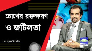 চোখে রক্তক্ষরণ হলে কি কি জটিলতা হয় I । Prof Dr Harun Ur Rashid  Dhaka Eye Care Hospital [upl. by Whale388]