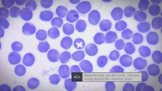 Geimsa Stain  for Plasmodium and Babesia Parasite Diagnostics [upl. by Agnella128]