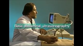 How to do abdominal ultrasound examination [upl. by Attenev]