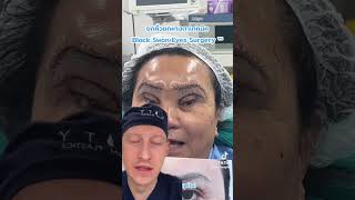 Shocking Black Swan Eye Surgery Trend  Plastic Surgeon Reacts [upl. by Nylde]