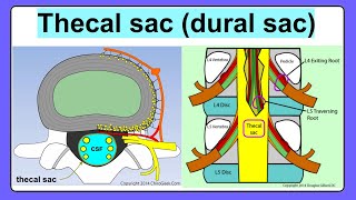 thecal sac [upl. by Yelyr956]