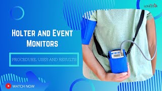 Holter and Event Monitors Procedure Uses and Results [upl. by Tennos669]