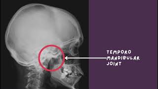 VIDEO PEMBELAJARAN  SKULL RADIOGRAPHY  RADIOLOGI MALANG [upl. by Susana]