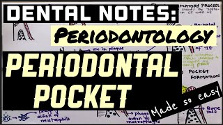 PERIODONTAL POCKET PART I II PERIODONTOLOGY II DENTAL NOTES II PATHOGENESIS II SO EASY [upl. by Yatnahs]