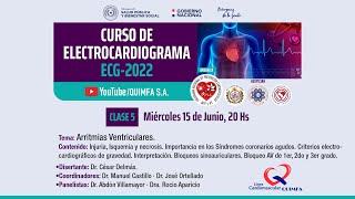 Curso de Electrocardiograma ECG2022 Clase 5 [upl. by Keavy]