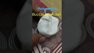 Buccal extension plaster model cavity shorts bds dentist [upl. by Sicular]