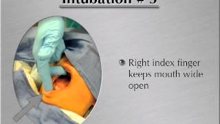 Endotracheal Intubation Video  MedicalGeekflv [upl. by Keiryt]