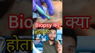 What is Biopsy shorts [upl. by Joon]