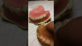 DIY DENTURES 23 [upl. by Sirac]