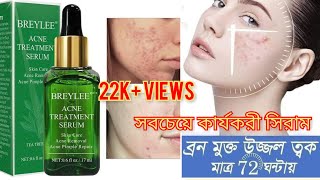 Breylee Acne treatment serum details and Review  ব্রণ নিয়ে চিন্তা আর না মাত্র ১ মাসে ক্লিয়ার স্কিন [upl. by Ynoble]