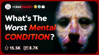 Psychologists Share The Creepiest Mental Conditions  Reddit Stories [upl. by Acassej]