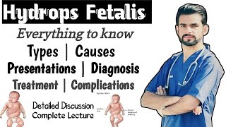 Hydrops Fetalis  causes types management complications [upl. by Curr]