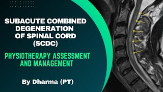 Subacute Combined Degeneration of Spinal Cord SCDC  Physiotherapy Assessment and Management [upl. by Notse589]