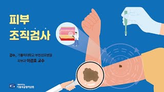 가톨릭중앙의료원 건강매거진 피부 조직검사 [upl. by Shanon]