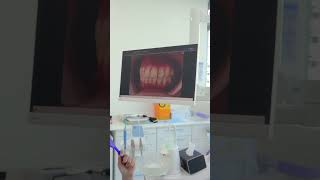 Cementation Dr Turab at Queens Medical Center  Dubai UAE [upl. by Garrard]