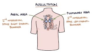 Heart murmurs for beginners Part 2 Atrial septal defect ventricular septal defect amp PDA🔥🔥🔥🔥 [upl. by Stoddard]