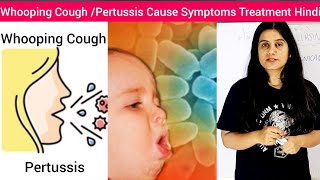 Whooping CoughPertussis  Cause Symptoms Treatment in Hindi  Pertussis Cause Symptom Treatment Hin [upl. by Elsie]