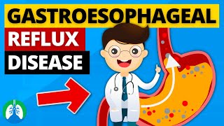 Gastroesophageal Reflux Disease GERD Explained [upl. by Delia]