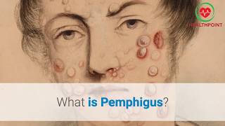 What is Pemphigus Causes Pictures Images Signs and Symptoms of Pemphigus Vulgaris [upl. by Erdman828]