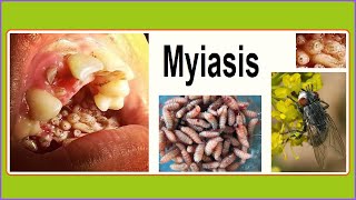 myiasis [upl. by Norvan]