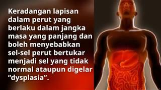 Apakah penyebab dan pencegahan untuk gastrik kronik Chronic Gastritis [upl. by Jamieson263]