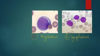 Myeloblast vs Lymphoblast mnemonic [upl. by Ateekram]