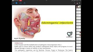 Odontogenic infections surgery 4th stageجراحة فم مرحلة رابعةطب اسنان [upl. by Bland]