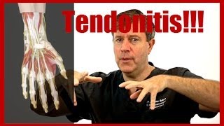 Do I Have Tendonitis In My Wrist [upl. by Terrene]