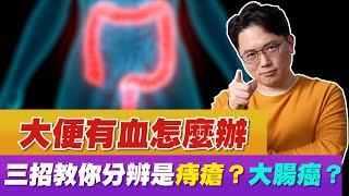 大便有血怎麼辦 ！？ 3招分辨 痔瘡 大腸癌【江P醫件事86】 [upl. by Jerman]