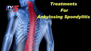 Causes Symptoms amp Treatments For Ankylosing Spondylitis  KIMS Hospitals  Health File  TV5 News [upl. by Shedd]