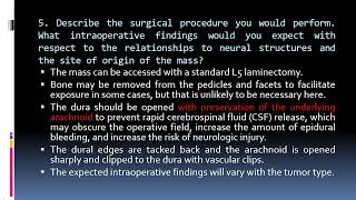 127 Intradural Spinal Tumor [upl. by Hanavas]