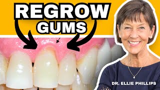 How To REGROW Receding Gums FIX Gum Recession At Home [upl. by Syned529]