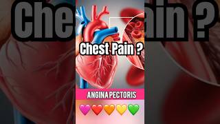 Angina in Tamil  Chest Pain in Tamil  heartattack [upl. by Ssegrub]