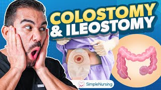 Colostomy and Ileostomy Nursing  Indications Complications Care EASY [upl. by Arratal]