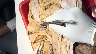 Lateral wall of nose dissection and sagittal section of head and neck [upl. by Berrie]