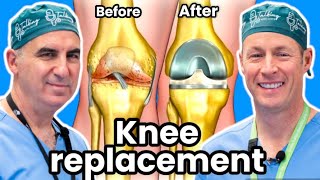 Knee Replacement  How To Know If You Need One [upl. by Avilo168]