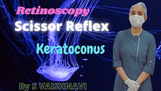 Retinoscopy in Keratoconus  SCISSOR REFLEX [upl. by Hakkeber865]