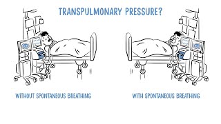 Transpulmonary Pressure Monitoring by Dräger [upl. by Novek]