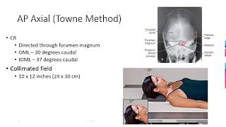 Radiographic Positioning of the Skull [upl. by Artenal]