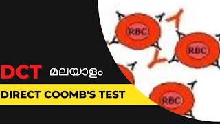 DCTDirect Coombs test മലയാളം [upl. by Shriner134]