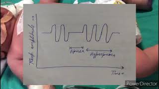 Respiration in children  Pediatrics [upl. by Aneeb]