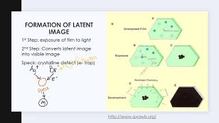 Screen Film Radiography Image Formation amp Characteristics [upl. by Sachiko]