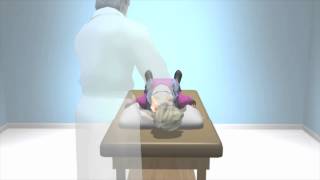 Dix Hallpike to Diagnose BPPV Dizziness [upl. by Alleber]